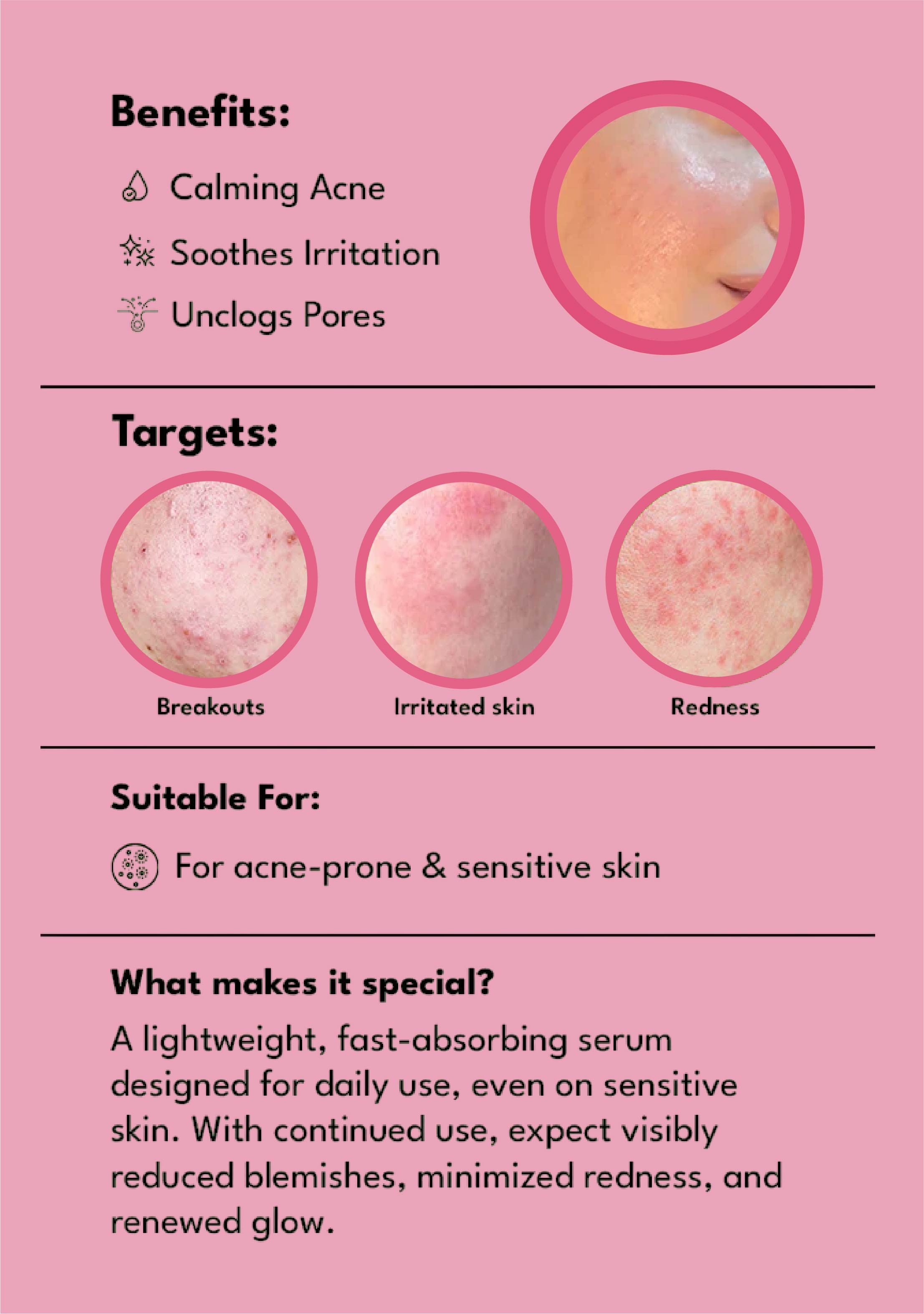 Acne Clear Serum