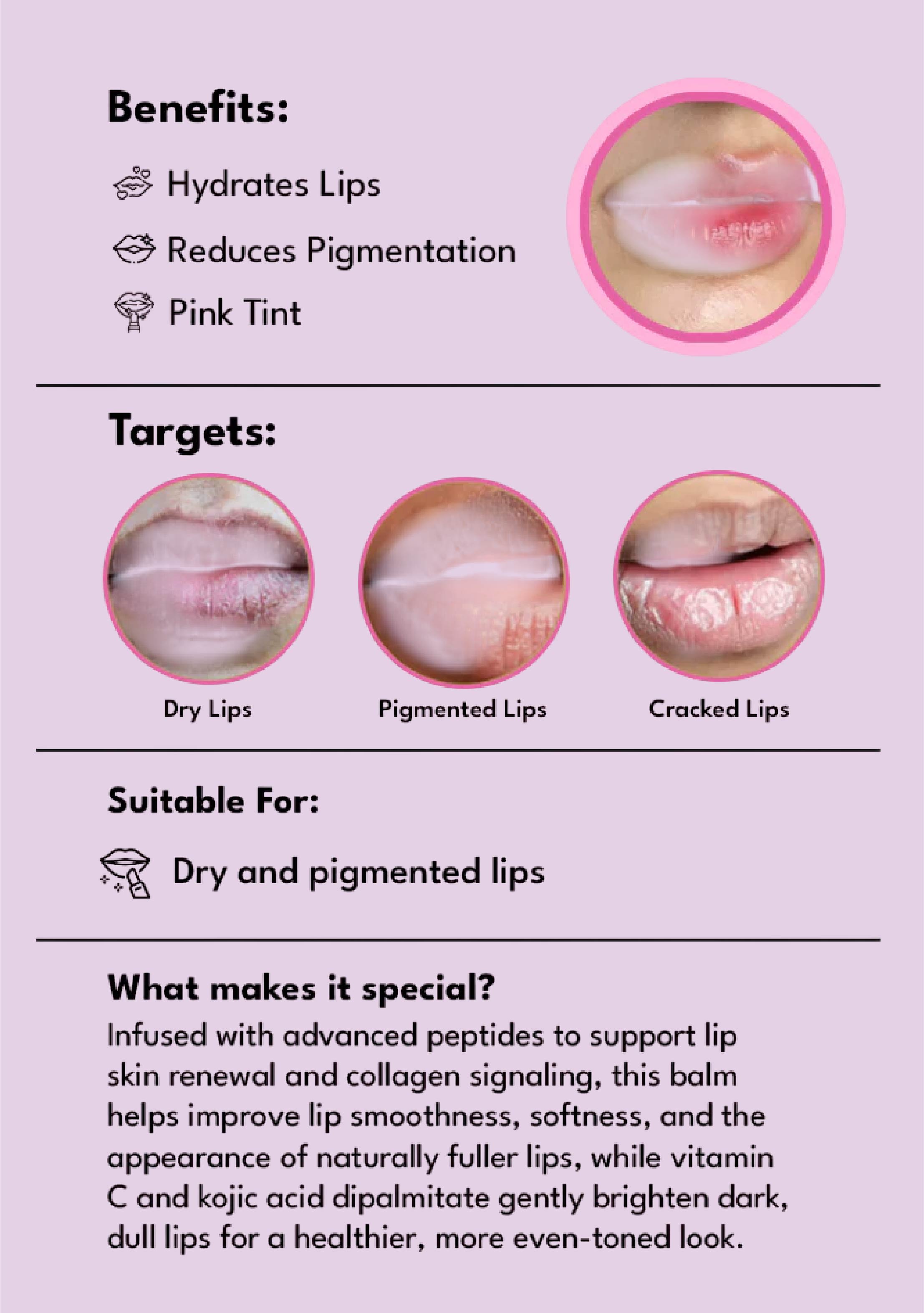 Lip Balm